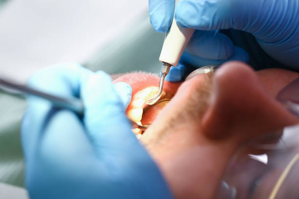 Best Same-Day Emergency Dentist in Conway Springs, KS